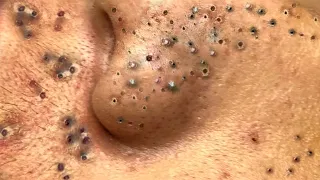 Most Satisfying and Relaxation with An Spa Video #5446