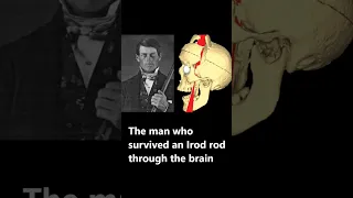 A Pole Through the Brain | The Incredible Survival Story of Phineas Gage #shorts 11.ai