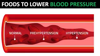 Foods That Lower Blood Pressure Without Medications