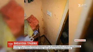 На Миколаївщині 11-річному школяру вибухом відірвало руку