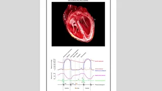 BIO 105-Altered Perfusion, Diffusion, Ventilation and Elimination