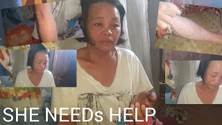 Siya Po Si LOLETA ALOGBATE Humingi po ng TULONG para sa kanyang SAKIT