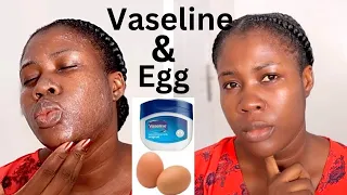 I Tested Asian magical anti-aging secret | Vaseline and Egg. Fades Dark Spots and Pores overnight.