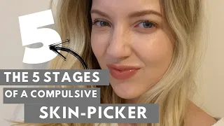 SKIN PICKING GOT YOU DOWN? DID YOU KNOW THESE 5 STAGES OF COMPULSIVE SKIN PICKING? 🤔😟