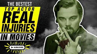 He Lost His Finger?! Real Injuries You Actually See in Movies! The Bestest Channel