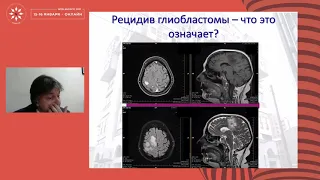 Исследования в онкологии 2020: Первичные опухоли головного мозга