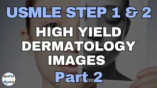 High Yield Dermatology Images | USMLE/Step 1/Step 2/COMLEX (part 2)