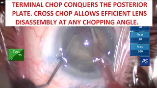 TBWTDCS #176: Terminal Chop Conquers Posterior Plate. Cross Chop Offers Versatile Chopping Angles.