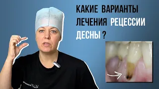 Какие варианты лечения рецессии десны🤔