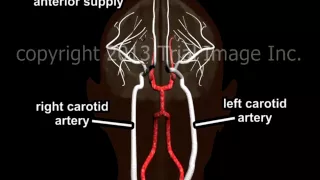 Blood Supply to the Brain - Animation and Narration by Dr. Cal Shipley, M.D.