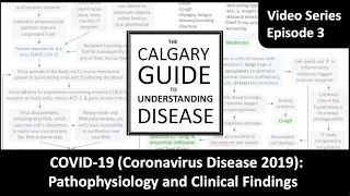 COVID19 Pathophysiology and Clinical Findings