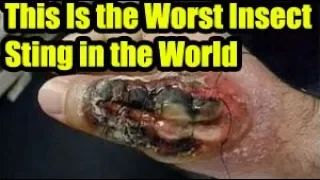 This Is the Worst Insect Sting in the World | Amazing  Worst Insect Sting in the World