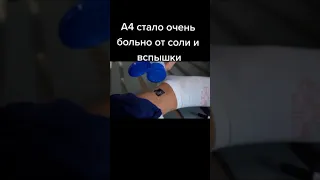 А4 стало больно от соли и вспышки