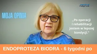 Endoproteza biodra - 6 tygodni po