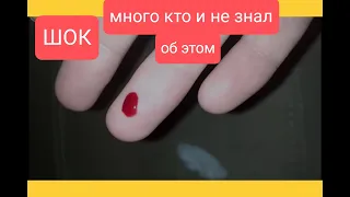 После этого видео кому-то проще станет жить. Скарификатор ланцет, безболезненный забор крови