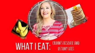 WHAT I EAT: Crohn's Disease and Ostomy Diet Tips