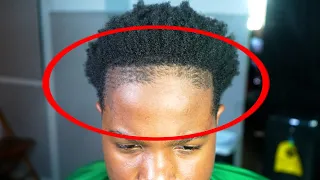 his last barber VIOLATED his hairline! lets fix it!