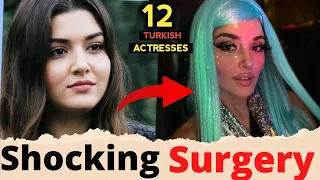 12 Turkish Actresses Shocking Transformation Before and After Surgery | Hande Ercel