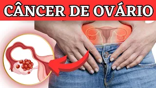 10 Sinais de Câncer de Ovário que não podem ser ignorados.