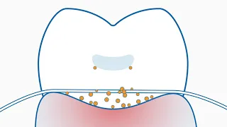 Curaprox Interdental Brushes vs Floss