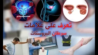 تعرف على أعراض سرطان البروستات