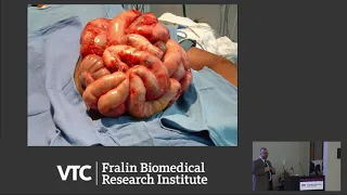 A Decade’s Work in Radically Transforming the Resuscitation of Hemorrhagic Shock in Trauma