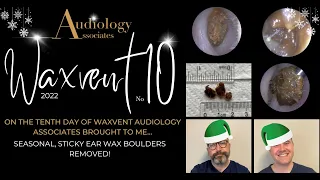 STICKY EAR WAX BOULDERS REMOVED - EP595