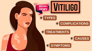 All About Vitiligo in Hindi : Cure, Symptoms, Treatments, Types, Causes, Complications | सफेद दाग |