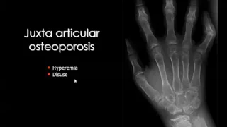 Imaging of polyarthropathies I   DRE 12   Dr Mamdouh Mahfouz