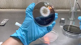 Fungi transfer on Agar (subculture)