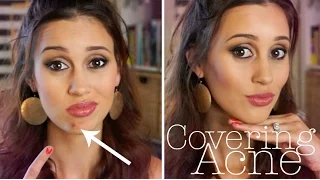 How to Cover a Pimple FLAWLESSLY!