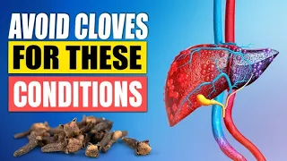 DON’T Eat Cloves Before Watching - Avoid Cloves with These Medical Conditions