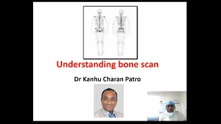 UNDERSTANDING BONE SCAN