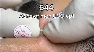 |644| Acne of a men U30 02/05/2024 ep1