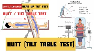 HUTT | head up tilt test #hutt #neurology @bipinsinghrawat