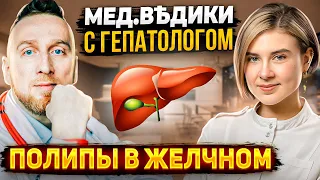 Полипы желчного пузыря || Какой полип может стать раком