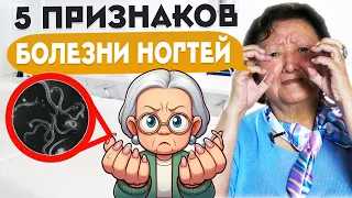 Кто живет под нашими ногтями?