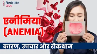 Anemia Symptoms, Causes And Treatment In Hindi | शरीर में खून की कमी यानी #Anemia कितना ख़तरनाक है?