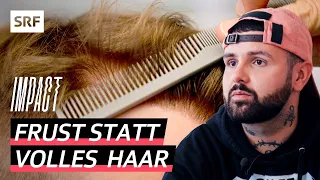 Haartransplantation mit Folgen – Männer leiden nach misslungenen Schönheitseingriffen | Impact | SRF