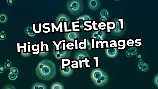 USMLE Step 1 High Yield Images (Part 1) [REFRESHED]