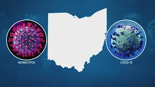 OhioHealth doctor discusses spread of new COVID-19 subvariant, Monkeypox