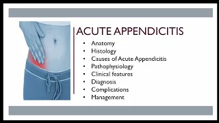 Acute appendicitis - surgical anatomy,etiology, pathogenesis, clinical features,  diagnosis