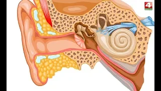 Вопрос здоровья. Тугоухость. 07.05.2018