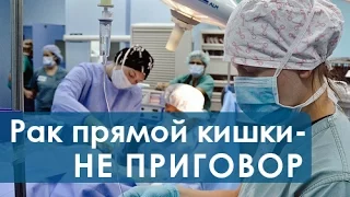 Операция на прямой кишке. Сфинктеросохраняющая операция на прямой кишке.