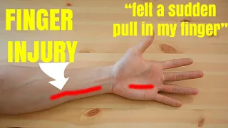 Finger injury FIXED in 4 minutes!! and WHAT IS IT? | Expert advice from Physiotherapist