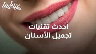 ما هي أحدث تقنيات تجميل الأسنان؟ - دنيا يا دنيا #تجيمل_الأسنان