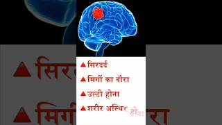 Brain Tumor Cancer Awareness Month- Sign& Symptoms | Dr Amit Pandey | Apollo Hospital Lucknow