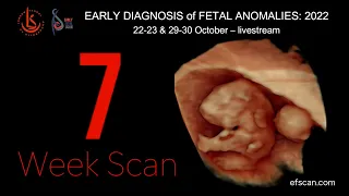 7 Week Scan in Fetal Medicine: Early Fetal Scan Conference 2022