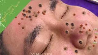 Satisfying videos for Relaxation with XINH SPA CHANNEL 5 #229