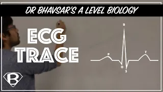 A level biology: ECG trace